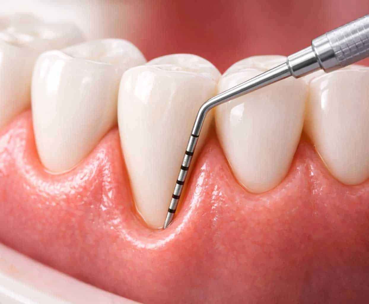 Periodoncia y salud gingival